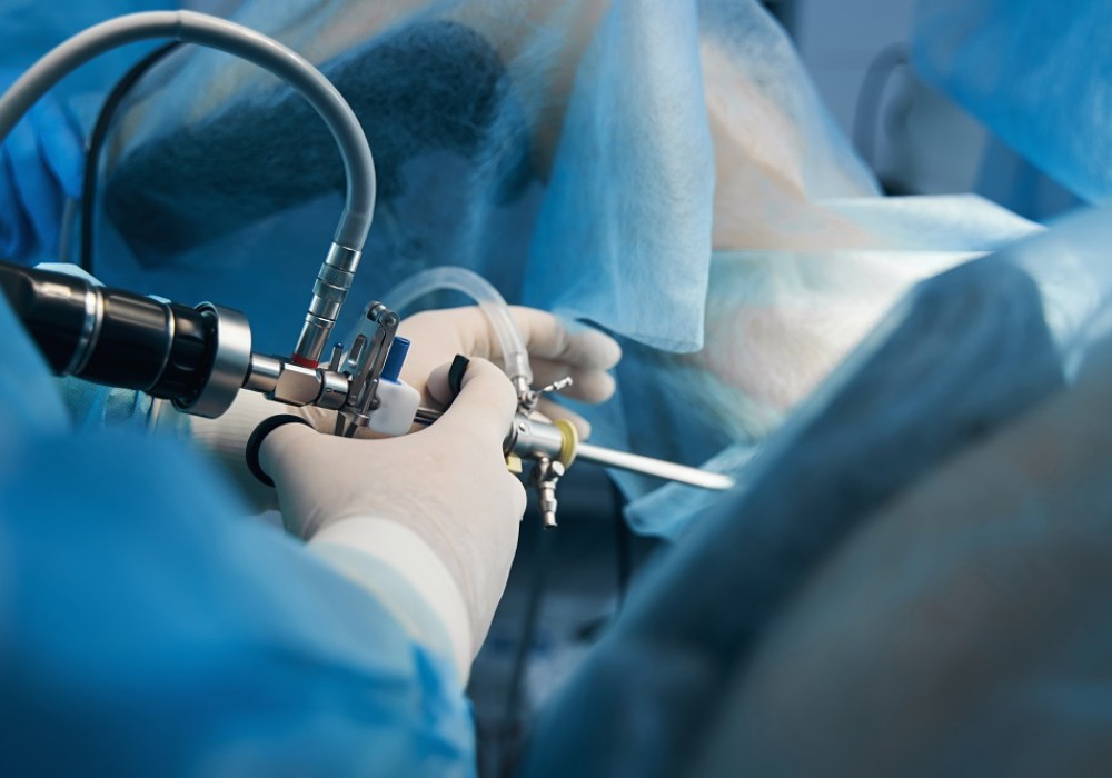 Die präzise Instrumentführung eines Endoskops während einer Operation 